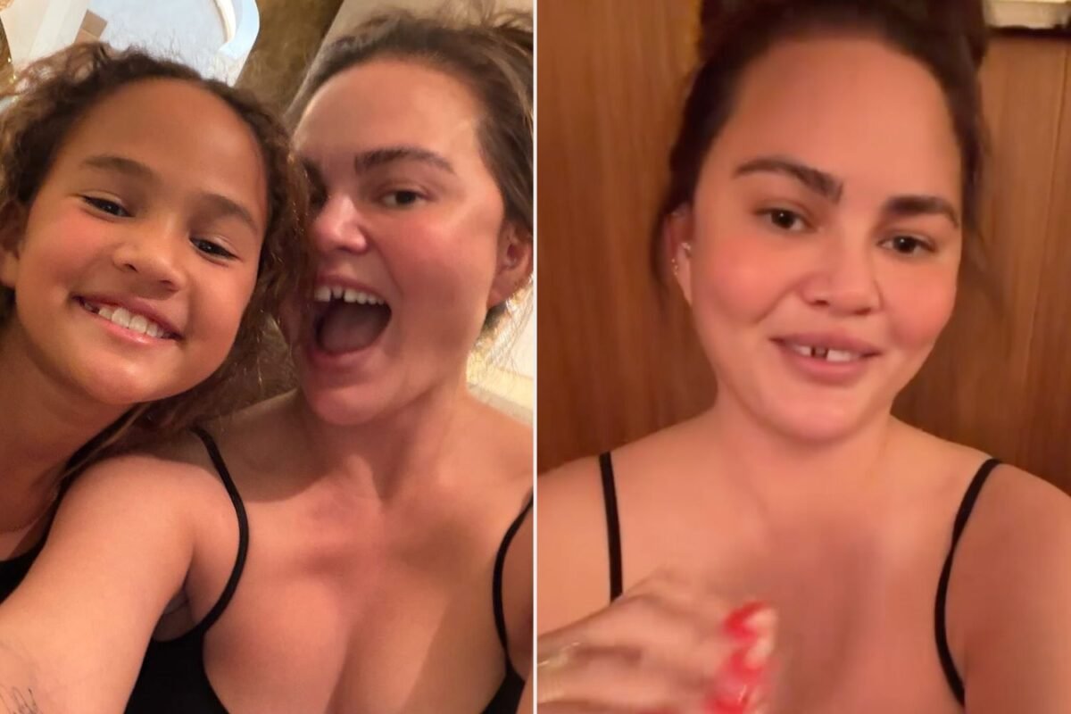 Chrissy Teigen’s Wild Holiday Fun Leads To An Unexpected Tooth Loss —