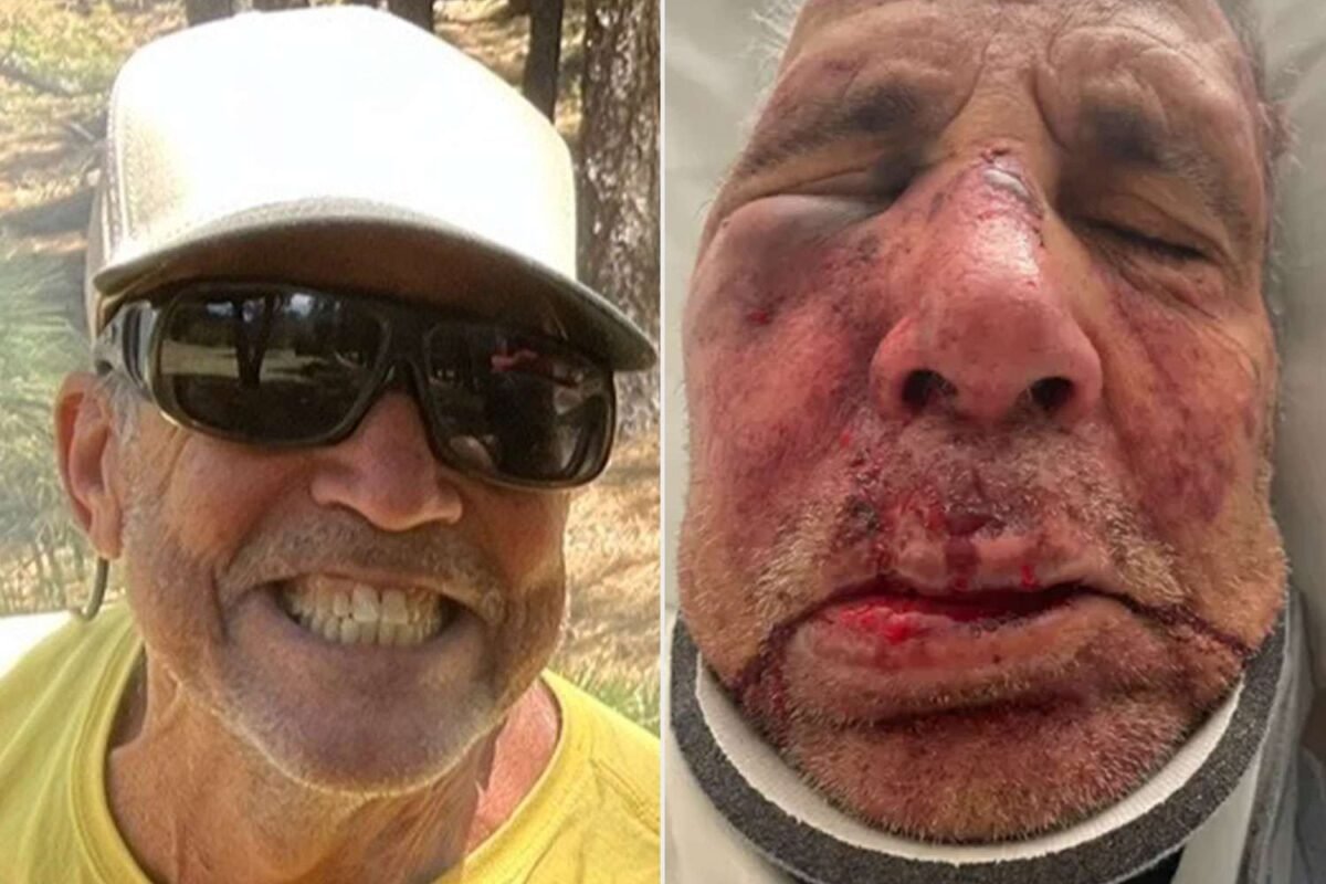 Phoenix Street Shockwave: Was This Bicycle Attack A Random Act Of Violence,