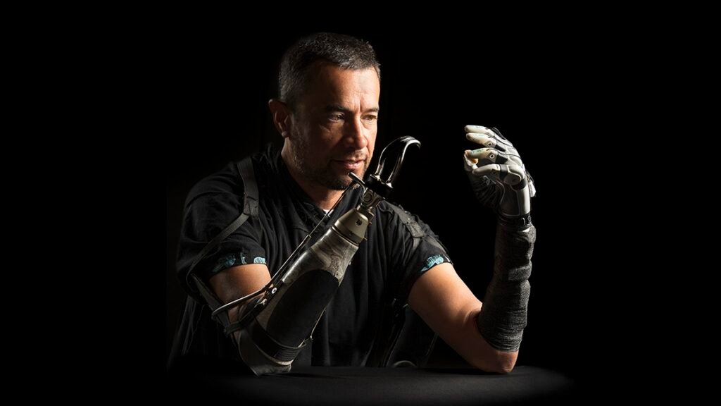 Is Ai Finally Making Prosthetic Hands Truly Human Like? Forget Everything You Thought