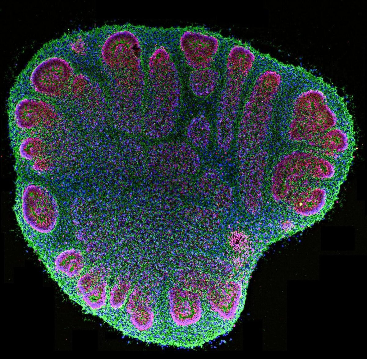 The Controversial Science Of Brain Organoids: Are We Playing God With Human