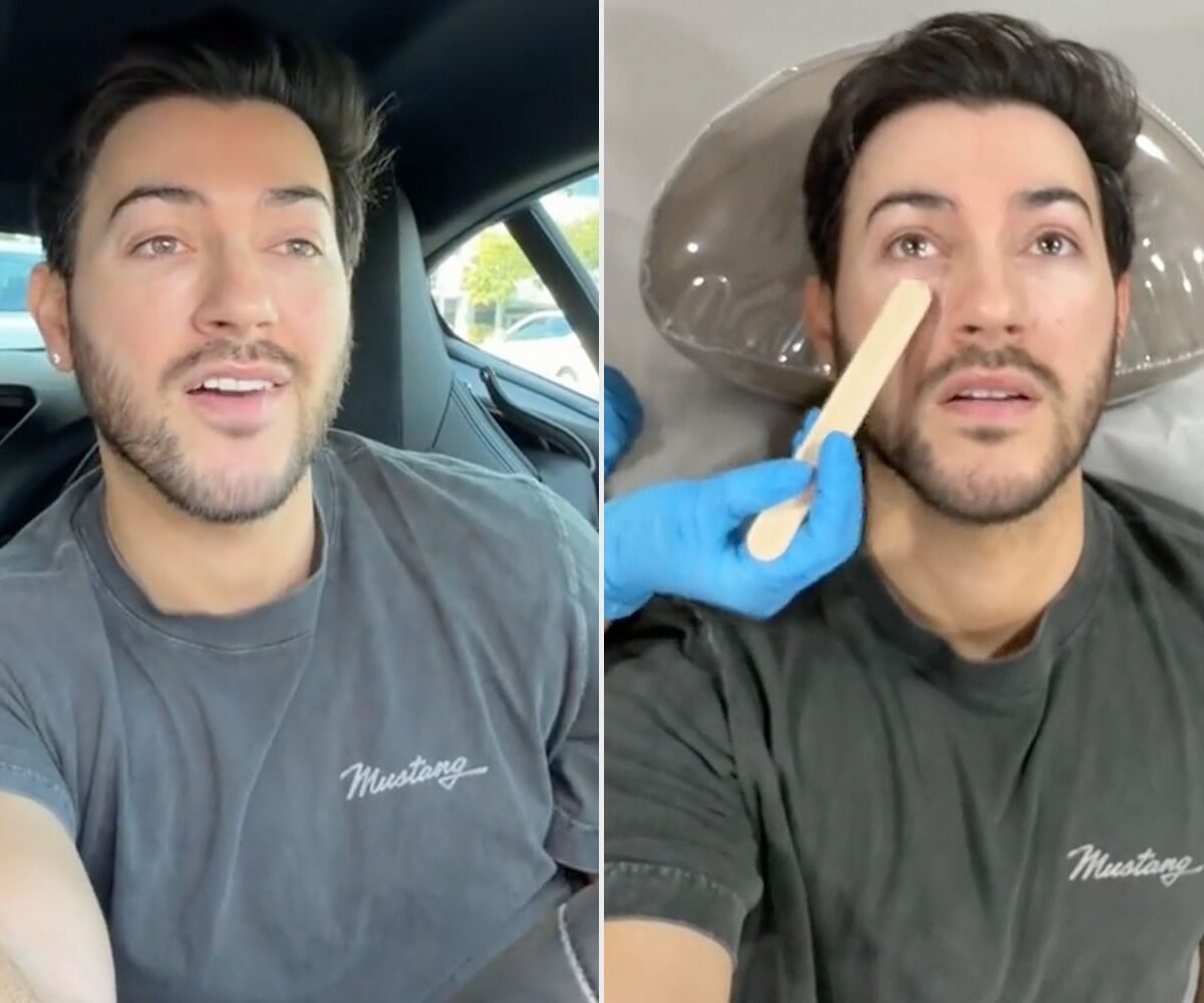 Omg, Did This Tiktok Creator Just Reverse 8 Years Of Facial Filler?
