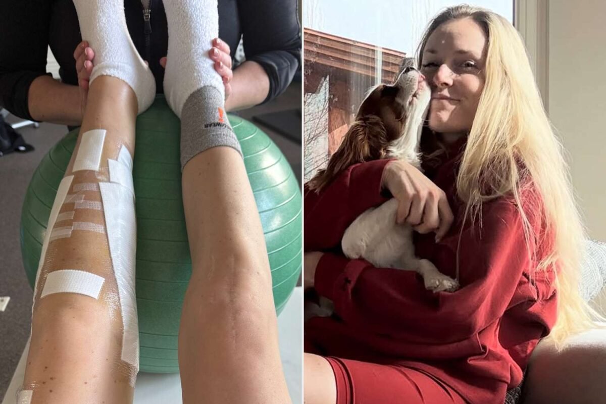 Vonn’s Shocking Instagram Confession: Is This Her Most Brutal Battle To Date?